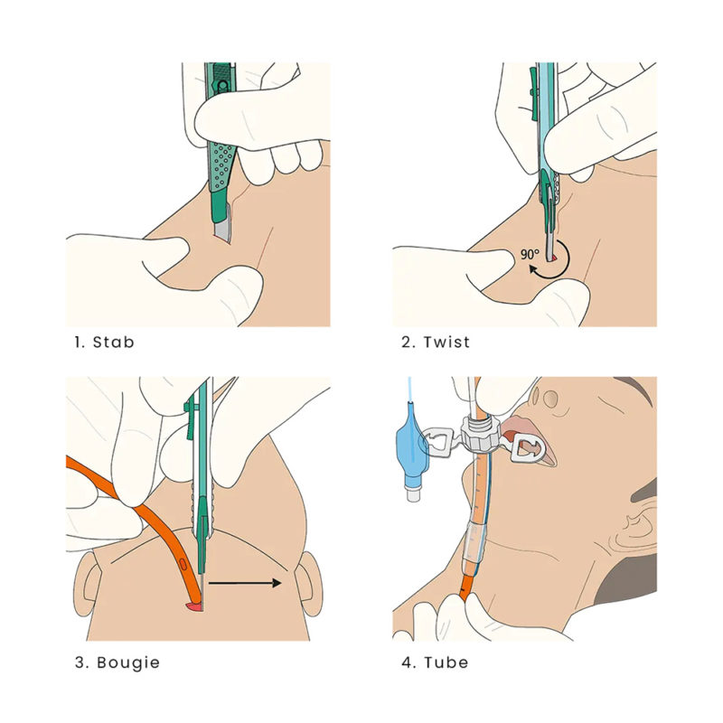 Cric Kit - ScalpelCric Cricothyrotomy Kit - Image 2